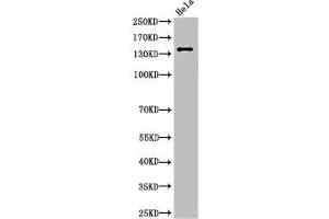 Western Blot analysis of HeLa cells using Cleaved-Spectrin α II (D1185) Polyclonal Antibody (SPTAN1 antibody  (Cleaved-Asp1185))
