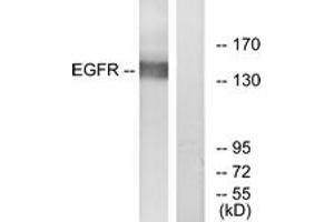 Western blot analysis of extracts from A431 cells, treated with EGF 40myM 10', using EGFR (Ab-869) Antibody. (EGFR antibody  (AA 836-885))