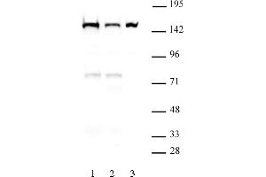 DHX9 antibody (mAb) (Clone 8E3) tested by Western blot. (DHX9 antibody  (N-Term))