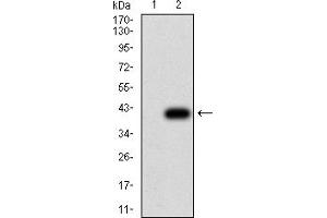 Western Blotting (WB) image for anti-Activin Receptor Type I (ACRV1) (AA 21-120) antibody (ABIN5912647) (ACVR1 antibody  (AA 21-120))