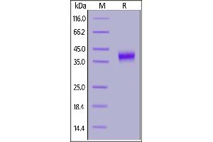 SDS-PAGE (SDS) image for Folate Receptor 1 (Adult) (FOLR1) (AA 25-233) (Active) protein (His tag,FITC) (ABIN6973072)
