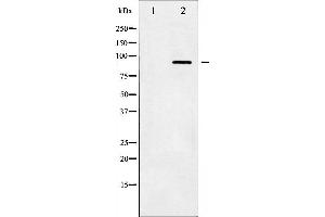 Western blot analysis of IKK- beta phosphorylation expression in TNF-a treated HeLa whole cell lysates,The lane on the left is treated with the antigen-specific peptide. (IKBKB antibody  (pTyr199))