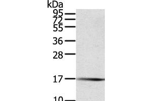 Western Blot analysis of Human fetal muscle tissue using PTPMT1 Polyclonal Antibody at dilution of 1:200 (PTPMT1 antibody)