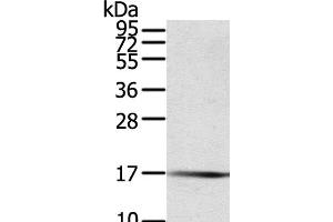 Western Blot analysis of Human fetal muscle tissue using PTPMT1 Polyclonal Antibody at dilution of 1:200