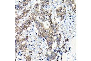 Immunohistochemistry of paraffin-embedded mouse testis using PIWIL4 Rabbit pAb (ABIN6132982, ABIN6145704, ABIN6145705 and ABIN6217111) at dilution of 1:100 (40x lens). (PIWIL4 antibody  (AA 260-460))