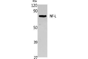 Western Blot analysis of extracts from Jurkat cells, using NF-L Polyclonal Antibody. (NEFL antibody  (C-Term))