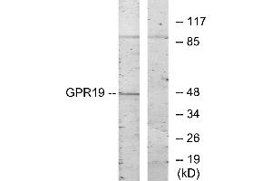 Western blot analysis of extracts from HeLa cells, using GPR19 antibody. (GPR19 antibody)