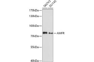 Western blot analysis of extracts of various cell lines, using AMFR antibody (ABIN1678650, ABIN3018012, ABIN3018013 and ABIN6220335) at 1:1000 dilution. (AMFR antibody  (AA 384-643))