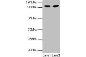 Western blot All lanes: PYGL antibody at 2 μg/mL Lane 1: 293T whole cell lysate Lane 2: HepG2 whole cell lysate Secondary Goat polyclonal to rabbit IgG at 1/10000 dilution Predicted band size: 98, 94 kDa Observed band size: 98 kDa (PYGL antibody  (AA 2-846))