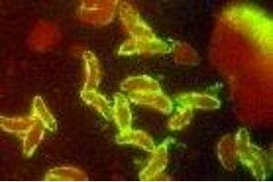 Image no. 1 for anti-Toxoplasma Gondii P30 antibody (ABIN6252913) (Toxoplasma Gondii P30 antibody)