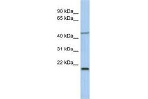 Image no. 1 for anti-Kruppel-Like Factor 15 (KLF15) (AA 215-264) antibody (ABIN6742232) (KLF15 antibody  (AA 215-264))