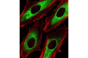 Fluorescent image of Hela cells stained with EEF1B2 Antibody . (EEF1B2 antibody  (AA 54-86))
