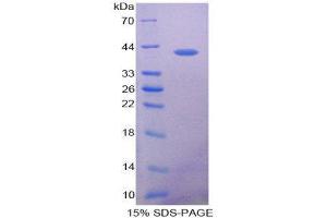 SDS-PAGE (SDS) image for Chemokine (C-X-C Motif) Ligand 17 (CXCL17) (AA 24-119) protein (His tag,GST tag) (ABIN1171631)