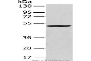 Western Blot analysis of 293T cell using CRTAM Polyclonal Antibody at dilution of 1:250