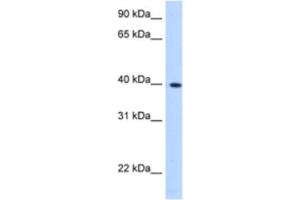Western Blotting (WB) image for anti-Lipoic Acid Synthetase (LIAS) antibody (ABIN2463206)