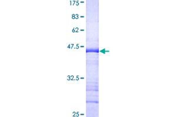 KAP1 Protein (AA 379-524) (GST tag)