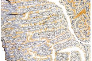 ABIN6262482 and ABIN6272876 at 1/100 staining Rat colon tissue by IHC-P. (IFT81 antibody)