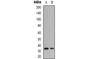 Western blot analysis of CDK4 expression in HepG2 (A), K562 (B) whole cell lysates. (CDK4 antibody  (N-Term))