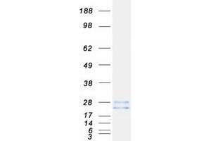 Ras Homolog Gene Family, Member C (RHOC) (Transcript Variant 1) protein (Myc-DYKDDDDK Tag)