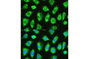 Immunofluorescence analysis of L929 cells using YTHDF1 Rabbit pAb  at dilution of 1:100. (YTHDF1 antibody)