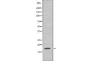 Western blot analysis of extracts from Jurkat cells, using RPS15 antibody. (RPS15 antibody  (C-Term))