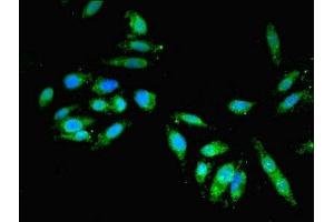 Immunofluorescent analysis of Hela cells using ABIN7154322 at dilution of 1:100 and Alexa Fluor 488-congugated AffiniPure Goat Anti-Rabbit IgG(H+L) (GBF1 antibody  (AA 1-85))