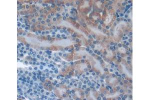 Used in DAB staining on fromalin fixed paraffin- embedded kidney tissue (PLA2G12A antibody  (AA 26-192))