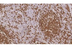 Immunohistochemistry (IHC) image for anti-Membrane-Spanning 4-Domains, Subfamily A, Member 1 (MS4A1) antibody (ABIN7538861)