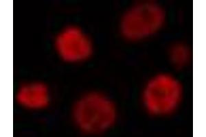 ABIN6274313 staining HT29 cells by IF/ICC. (MEF2B antibody  (Internal Region))