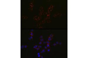 Immunofluorescence analysis of Jurkat cells using CCR5 Rabbit pAb (ABIN7266307) at dilution of 1:50 (40x lens). (CCR5 antibody  (AA 100-200))