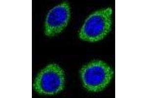 Confocal immunofluorescent analysis of HSD11B1L Antibody ) with U-251MG cell followed by Alexa Fluor 488-conjugated goat anti-rabbit lgG (green). (HSD11B1L antibody  (C-Term))