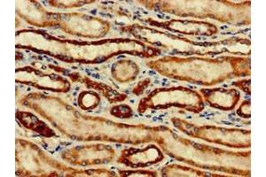 Immunohistochemistry of paraffin-embedded human kidney tissue using ABIN7171209 at dilution of 1:100 (SNCAIP antibody  (AA 309-553))