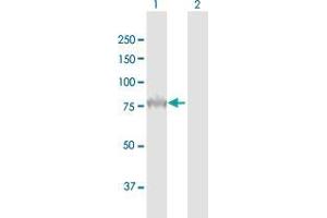 Western Blotting (WB) image for anti-Proprotein Convertase Subtilisin/kexin Type 9 (PCSK9) antibody (ABIN2752371)