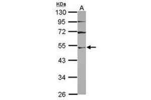 Image no. 1 for anti-Ubiquitin-Like Modifier Activating Enzyme 3 (UBA3) (AA 1-229) antibody (ABIN1501609) (UBA3 antibody  (AA 1-229))