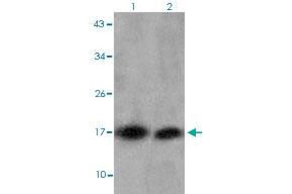 HIST1H3D antibody  (3meLys27)
