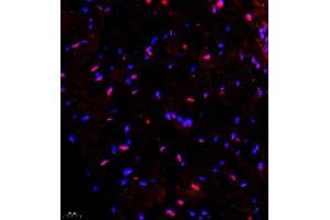 Immunofluorescence of paraffin embedded mouse heart using SMNDC1 (ABIN7075773) at dilution of 1:650 (400x lens) (SMNDC1 antibody)