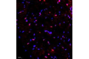 Immunofluorescence of paraffin embedded mouse heart using SMNDC1 (ABIN7075773) at dilution of 1:650 (400x lens)
