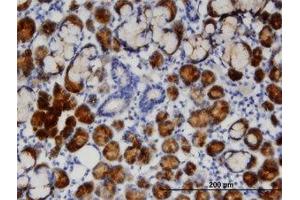 Image no. 1 for anti-Transcobalamin I (Vitamin B12 Binding Protein, R Binder Family) (TCN1) (AA 1-424) antibody (ABIN599447) (TCN1 antibody  (AA 1-424))