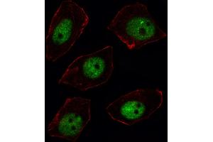 Fluorescent image of U251 cell stained with ARGBP2 Antibody (N-term).