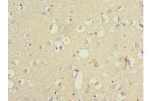 Immunohistochemistry of paraffin-embedded human brain tissue using ABIN7166001 at dilution of 1:100 (QKI antibody  (AA 1-341))