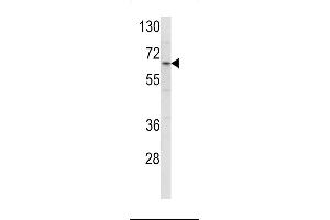 Western blot analysis of ENTH Antibody (Center) (ABIN390833 and ABIN2841059) in HL-60 cell line lysates (35 μg/lane).