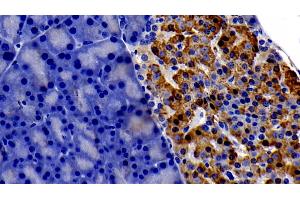 Immunohistochemistry (IHC) image for anti-Interleukin 6 Signal Transducer (Gp130, Oncostatin M Receptor) (IL6ST) (AA 26-323) antibody (ABIN7430558)