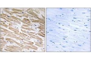 Immunohistochemistry analysis of paraffin-embedded human heart tissue, using NEURL2 Antibody. (NEURL2 antibody  (AA 99-148))