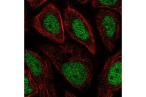 Immunofluorescent staining of SiHa cells with GTF2H3 polyclonal antibody  (Green) shows positivity in nucleus but excluded from the nucleoli. (GTF2H3 antibody)