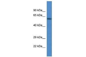 Western Blot showing HPSE antibody used at a concentration of 1 ug/ml against Jurkat Cell Lysate