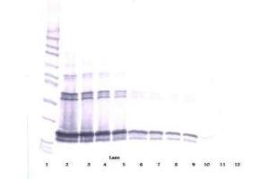 Image no. 1 for anti-Tumor Necrosis Factor (Ligand) Superfamily, Member 13b (TNFSF13B) antibody (ABIN465049) (BAFF antibody)