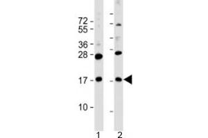 Western blot testing of human 1) MKN45 and 2) PANC-1 cell lysate with FAM159B antibody at 1:2000. (FAM159B antibody  (AA 121-154))