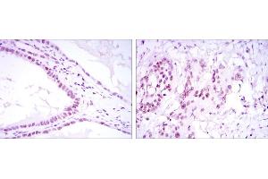 Immunohistochemical analysis of paraffin-embedded kidney convoluted tubule tissues (left) and esophageal cancer tissues (right) using SUZ12 mouse mAb with DAB staining. (SUZ12 antibody)