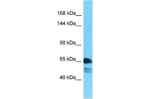 Western Blotting (WB) image for anti-ATPase, Cu++ Transporting, beta Polypeptide (ATP7B) (Middle Region) antibody (ABIN5514518)