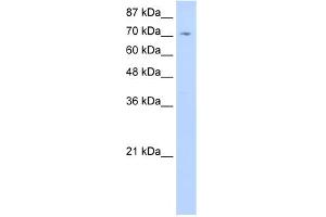 WB Suggested Anti-ZNF214 Antibody Titration:  0. (ZNF214 antibody  (C-Term))
